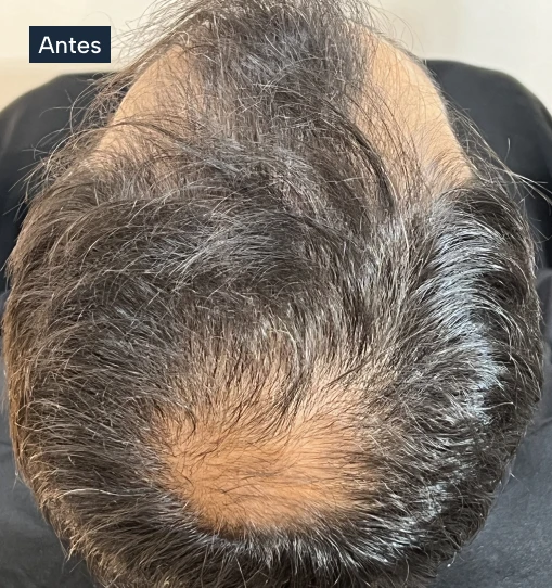 antd1.webp antd1.webp