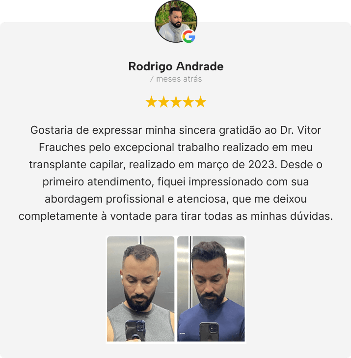 dep-mob-1.png